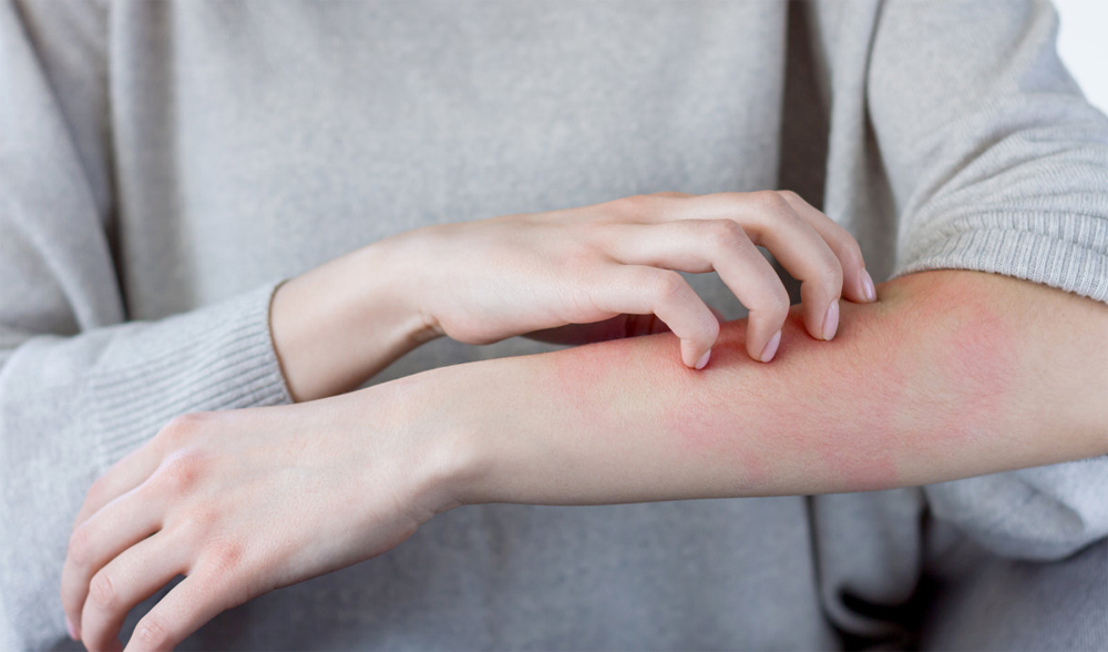 lavandería de ozono